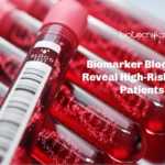 US Researchers Use Biomarker Blood Test To Reveal Heart Disease Risk Biomarker blood-test for heart patients