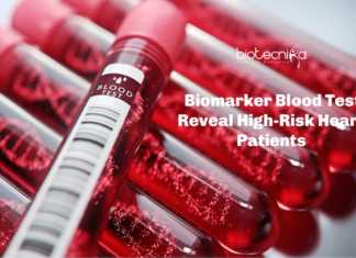 US Researchers Use Biomarker Blood Test To Reveal Heart Disease Risk Biomarker blood-test for heart patients