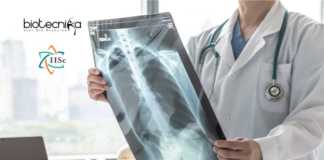 IISc Portable TB Device
