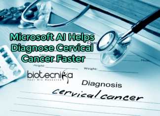 Microsoft-AI diagnoses cervical cancer