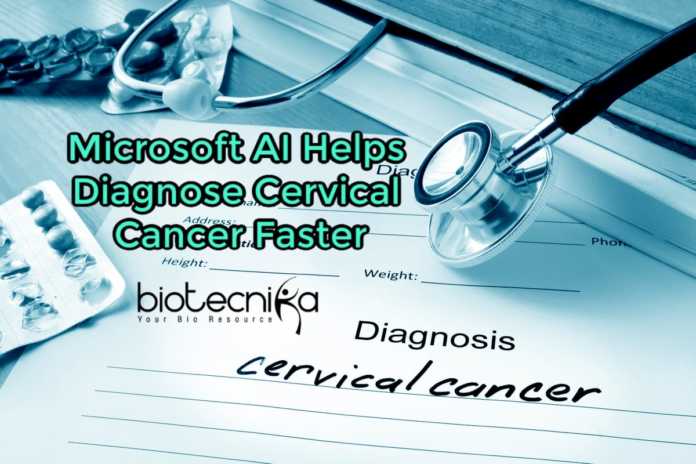 Microsoft-AI diagnoses cervical cancer