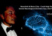Neuralink AI Brain Chip – Could Help Treat Severe Neurological Disorders Says, Elon Musk Neuralink AI Brain Chip - Could Help Treat Severe Neurological Disorders Says, Elon Musk