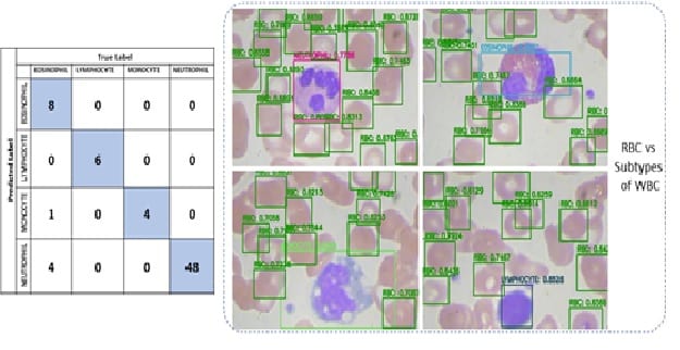 CSIR-CSIO Smart Microscope