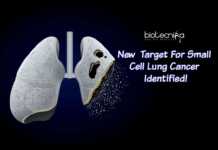 Biologists Discover New Target For Small Lung Cancer Therapy Target For Small Cell Lung Cancer