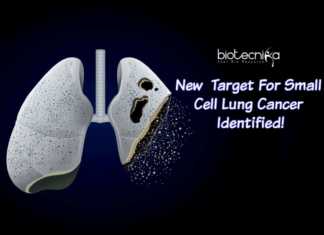 Biologists Discover New Target For Small Lung Cancer Therapy Target For Small Cell Lung Cancer