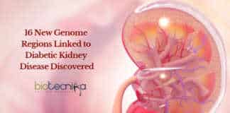 UCD Diabetes Kidney Research