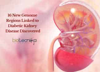 Discovery of 16 New Genome Regions Linked to Diabetic Kidney Disease UCD Diabetes Kidney Research