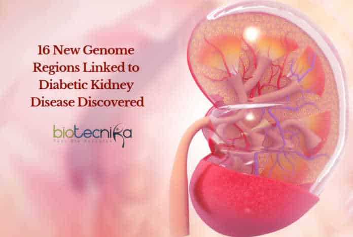 UCD Diabetes Kidney Research