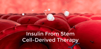 insulin from stem cell-derived therapy