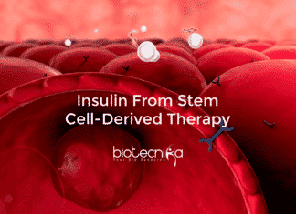 For First Time Insulin Made With Stem Cell-Derived Therapy insulin from stem cell-derived therapy