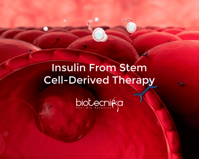 insulin from stem cell-derived therapy