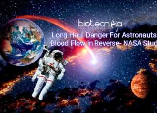 Spaceflight Can Halt & Reverse Blood Flow In Astronauts : NASA Study long-haul danger for astronauts