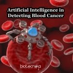 AI detects blood cancer