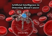 Detecting Blood Cancer Using Artificial Intelligence AI detects blood cancer