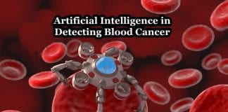 AI detects blood cancer