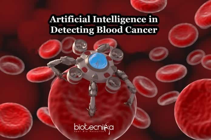 AI detects blood cancer