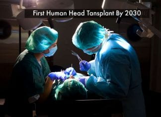 The First Human Head Transplant Maybe Just A Decade Away – Claims Scientists First Human Head Transplant