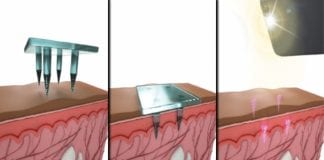 Medical Information Below Skin