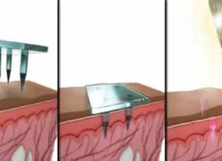 MIT Scientists Develops A Method To Store Medical Information Below The Skin Medical Information Below Skin