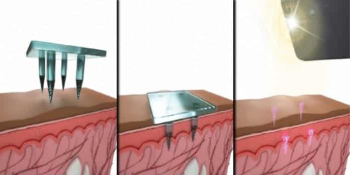 Medical Information Below Skin