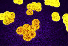 MRSA Superbugs Spreads Easily In Households – New study MRSA Superbug spread in households