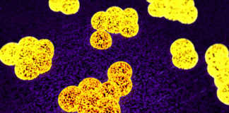 MRSA Superbug spread in households