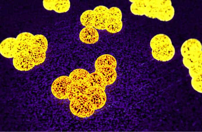 MRSA Superbug spread in households