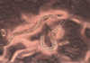 American University Researchers Sequence Devil Worm’s Genome Devils worm genome sequenced