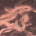 Devils worm genome sequenced