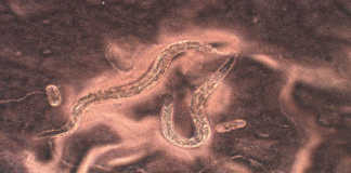 Devils worm genome sequenced
