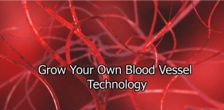 Personalized Blood Vessels