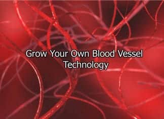 Personalized Blood Vessels