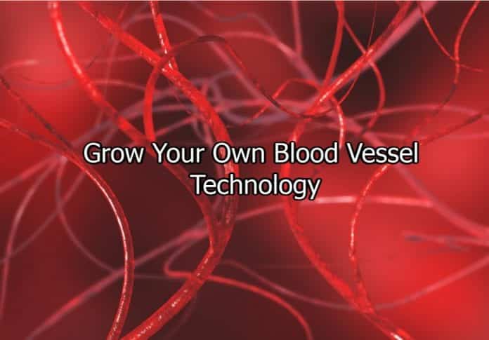 Personalized Blood Vessels
