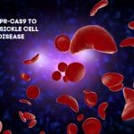 crispr sickle cell