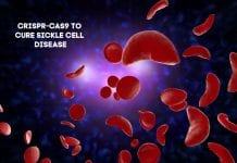 CRISPR-Cas9 Editing in Stem cells Genome to Cure Sickle Cell Disease crispr sickle cell