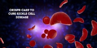crispr sickle cell