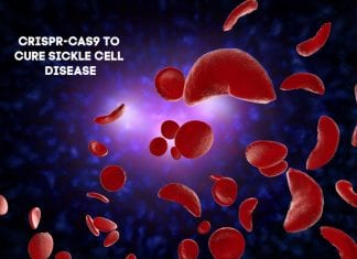 CRISPR-Cas9 Editing in Stem cells Genome to Cure Sickle Cell Disease crispr sickle cell