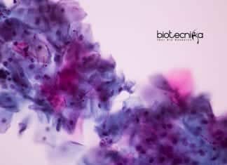 Researchers Unveil How Fungus Can Predict & Evade Immune System how fungus evade immune system