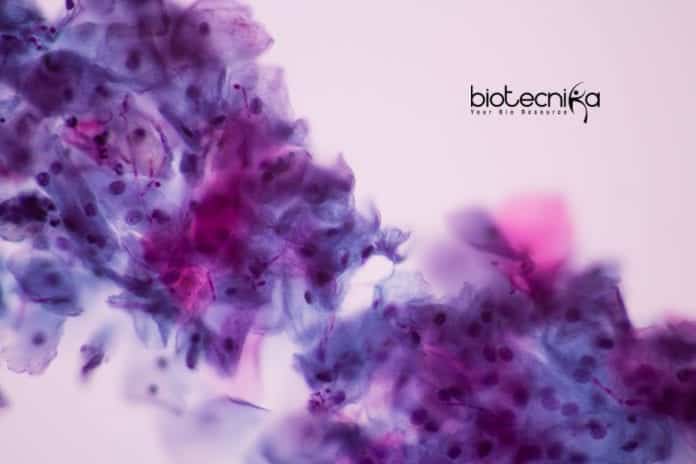 how fungus evade immune system