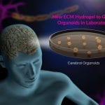 Regenerated Tissue For Patients Soon To Be A Reality – Say Scientists new ECM hydrogel to grow organoids