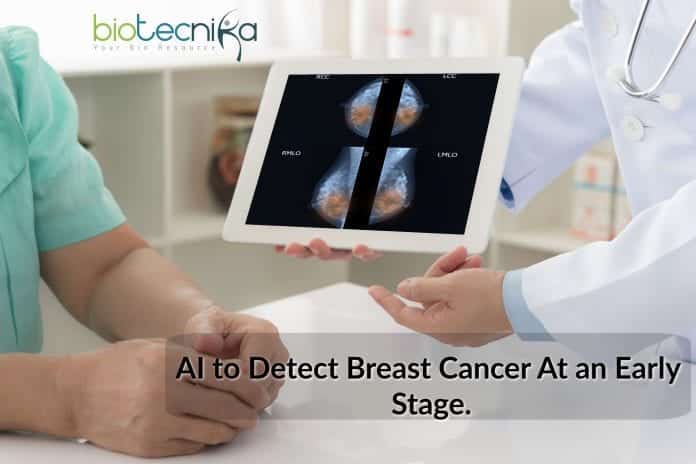 AI to detect breast cancer