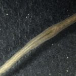 Gene That suppresses tissue growth, planarian flatworm