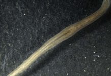 Gene That Halts Tissue Growth Identified By Scientists Gene That suppresses tissue growth, planarian flatworm