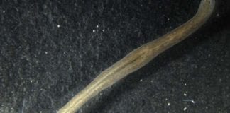 Gene That suppresses tissue growth, planarian flatworm