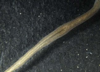 Gene That suppresses tissue growth, planarian flatworm