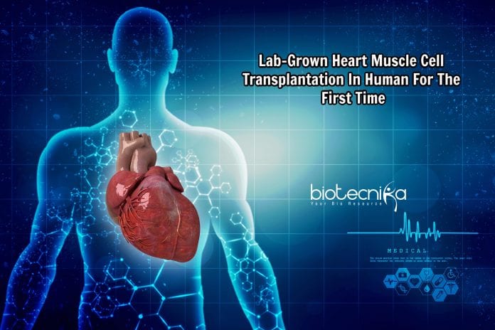 Lab-grown muscle cell transplantation
