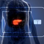 UVA's Artificial Pancreas:FDA Approved