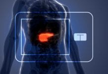 FDA Approves Artificial Pancreas System Developed By University of Virginia UVA's Artificial Pancreas:FDA Approved