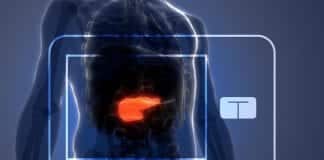 UVA's Artificial Pancreas:FDA Approved