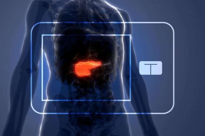 UVA's Artificial Pancreas:FDA Approved